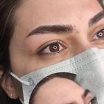 تصویر 0 مرکز خدمات و آموزش میکروبلیدینگ ، میکروپیگمنتیشن و ریموو