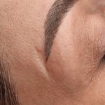 تصویر 4 مرکز خدمات و آموزش میکروبلیدینگ ، میکروپیگمنتیشن و ریموو