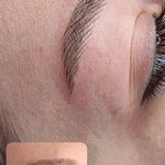 تصویر 0 مرکز خدمات و آموزش میکروبلیدینگ ، میکروپیگمنتیشن و ریموو