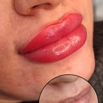 تصویر 3 مرکز خدمات و آموزش میکروبلیدینگ ، میکروپیگمنتیشن و ریموو