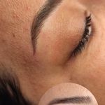 تصویر 1 مرکز خدمات و آموزش میکروبلیدینگ ، میکروپیگمنتیشن و ریموو