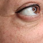 تصویر 3 مرکز خدمات و آموزش میکروبلیدینگ ، میکروپیگمنتیشن و ریموو