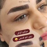 تصویر 3 مرکز خدمات و آموزش میکروبلیدینگ ، میکروپیگمنتیشن و ریموو