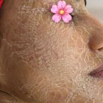 تصویر 4 جوانسازی،پاکسازی وفیشیال تخصصی اتاق پوست آزیتا