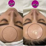 تصویر 1 جوانسازی،پاکسازی وفیشیال تخصصی اتاق پوست آزیتا