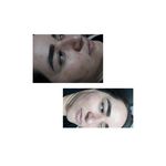 تصویر 0 جوانسازی،پاکسازی وفیشیال تخصصی اتاق پوست آزیتا