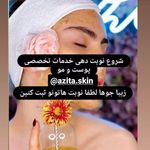 تصویر 2 جوانسازی،پاکسازی وفیشیال تخصصی اتاق پوست آزیتا