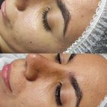 تصویر 3 جوانسازی،پاکسازی وفیشیال تخصصی اتاق پوست آزیتا