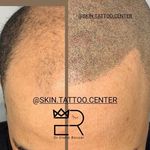 تصویر 0 کلینیک تخصصی مدیکال تتو و زیبایی