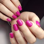 تصویر 2 خدمات کاشت و ترمیم ناخن زهره