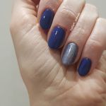 تصویر 0 خدمات کاشت و ترمیم ناخن زهره