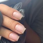 تصویر 2 خدمات کاشت و ترمیم ناخن زهره