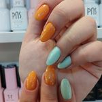 تصویر 1 خدمات کاشت و ترمیم ناخن زهره