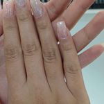 تصویر 2 خدمات کاشت و ترمیم ناخن زهره