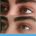 تصویر 0 فیشیال و ارایش دائم فرزانه