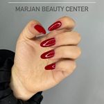 تصویر 3 کاشت تخصصی ناخن مرجان