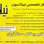 تصویر 2 اپیلاسیون نیلا