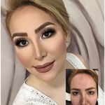 تصویر 4 مریم موسوی بیوتی سنتر