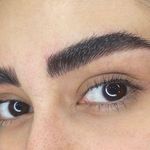 تصویر 1 میکروبلیدینگ دیا