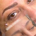 تصویر 1 مرکز فیبروز و ارایش دائم عاطفه