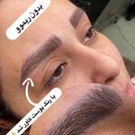 تصویر 4 مرکز فیبروز و ارایش دائم عاطفه