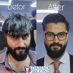 تصویر 2 آرایشگاه مردانه امیرمسعود (داماد ایرونی)