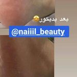 تصویر 1 کاشت ناخن پریناز