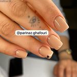 تصویر 4 کاشت ناخن پریناز