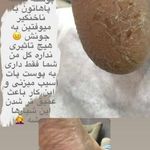 تصویر 4 کاشت ناخن پریناز