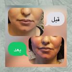تصویر 4 کلینیک پوست مو زیبایی ولیزر دکتراسماعیلی