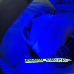 تصویر 3 کلینیک پوست مو زیبایی ولیزر دکتراسماعیلی