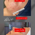 تصویر 2 کلینیک پوست مو زیبایی ولیزر دکتراسماعیلی
