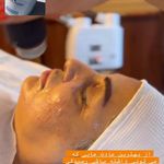 تصویر 4 کلینیک پوست مو زیبایی ولیزر دکتراسماعیلی