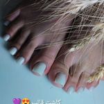 تصویر 1 کاشت ناخن آیسان
