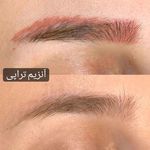 تصویر 1 مرکز تخصصی میکروبلیدینگ، اسکالپ و ریموو بانو زهرا مطوریان
