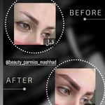 تصویر 1 کاشت ناخن فرناز مرادی