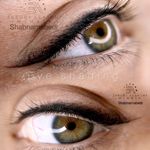 تصویر 2 مرکز تخصصی میکرو صورت  شبنم عابدی