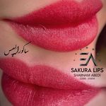 تصویر 3 مرکز تخصصی میکرو صورت  شبنم عابدی