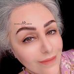 تصویر 0 مرکز تخصصی میکرو صورت  شبنم عابدی