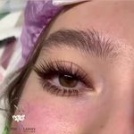 تصویر 3 مرکز تخصصی پوست و مژه و ابرو ندا رضايى