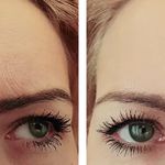 تصویر 0 کاشت ابرو، مو، ریش در شیراز