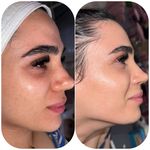 تصویر 4 سالن زیبایی نسرین بیات
