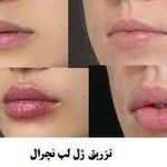 تصویر 4 کلینیک پوست مو زیبایی دکتر مسعود نوری