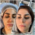 تصویر 3 کلینیک پوست مو زیبایی دکتر مسعود نوری