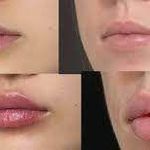 تصویر 0 کلینیک پوست مو زیبایی دکتر مسعود نوری