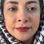 تصویر 0 کلینیک پوست مو زیبایی دکتر مسعود نوری