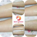 تصویر 2 اپیلاسیون تخصصی بدن بانوان در ساری