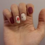 تصویر 1 انجام کلیه ناخن