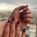 تصویر 2 انجام کلیه ناخن