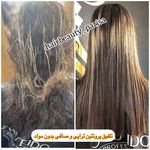 تصویر 1 کلینیک ناخن سپیده و صافی دائم مو